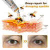 Botox Bee Venom Cream